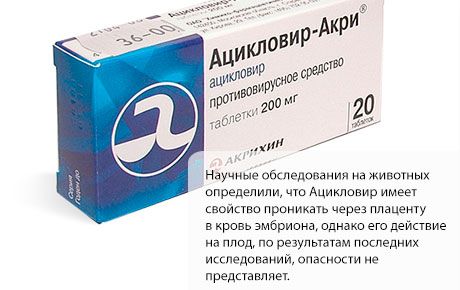 임신 중 Acyclovir