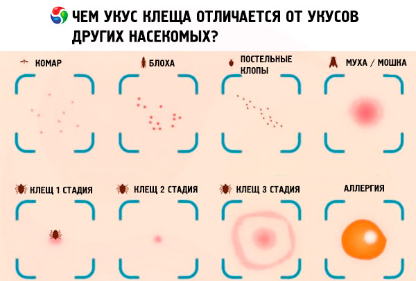 Фото укусы домашних муравьев