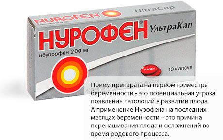 Nurofen 임신 중