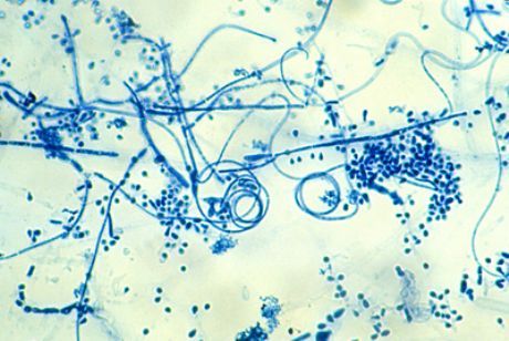 발의 표피 박테리아의 병인 (Trichophyton interdigitale)